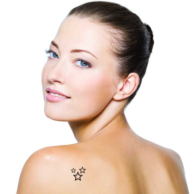 borrar eliminar tatuajes cordoba