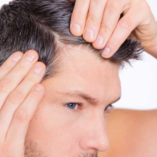 trasplante implante capilar cordoba